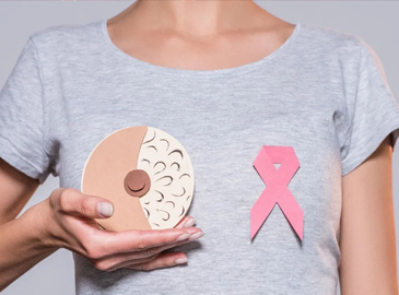 乳腺癌21基因